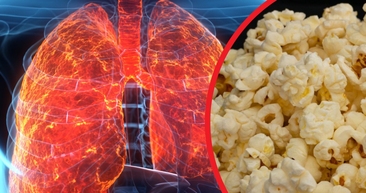 Grafika obalająca mit o „popcornowych płucach”.